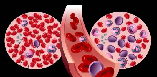 LEUCEMIA: HAGAMOS CONCIENCIA