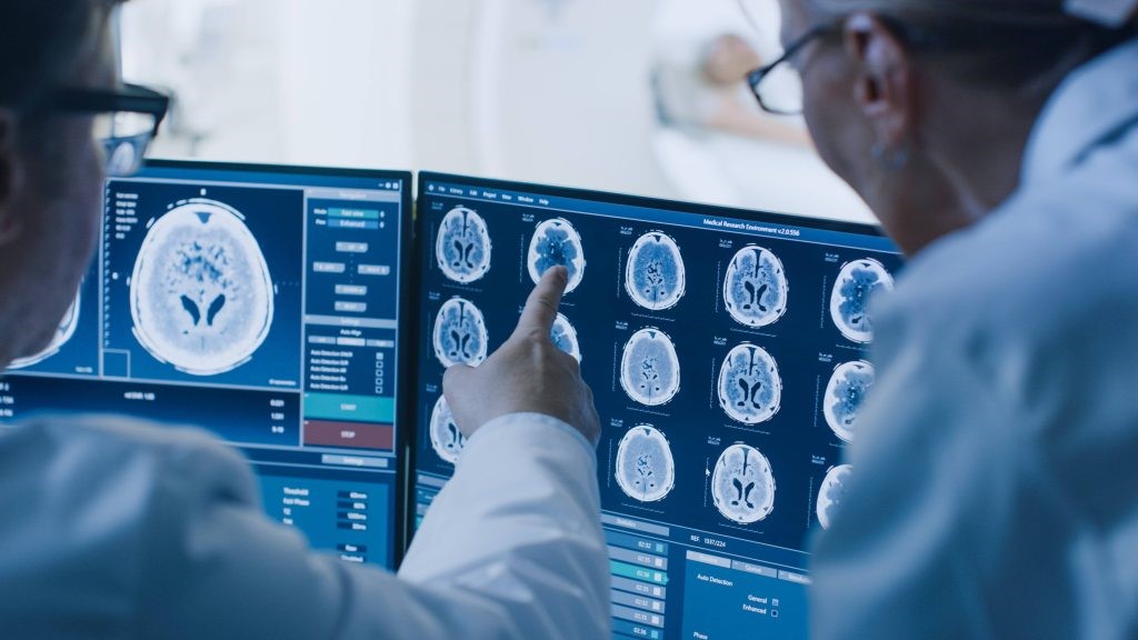 541-SALUD-BRAIN CANCER-FEATURED